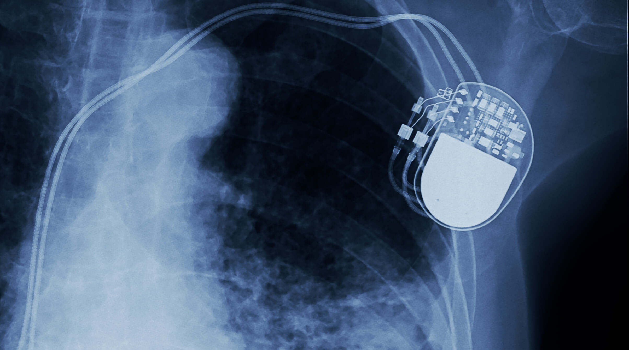 Reliability in medical devices - Sunbird Medical Devices
